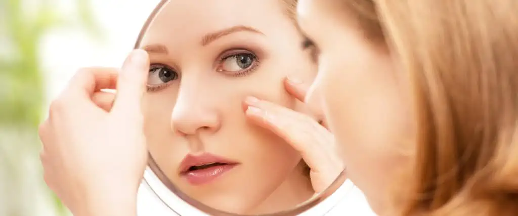 Acne Treatment Miami