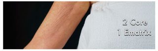 Patient 2 - Frontal After Patient 2 - Frontal After