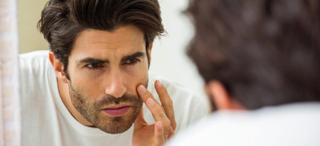 Brown Spot Removal, Miami, FL
