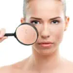 Cosmetic Treatments for Common Skin Conditions