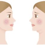 how to treat a double chin